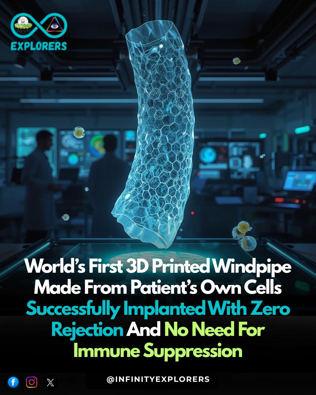Infinity - Doctors have successfully implanted the world’s first 3D ...
