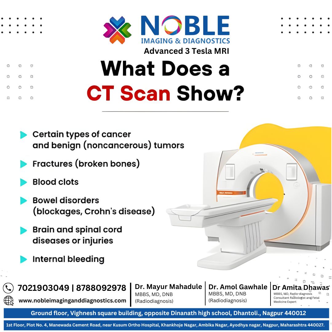 NOBLE - Discover what a CT Scan can reveal and why it’s one of the most ...