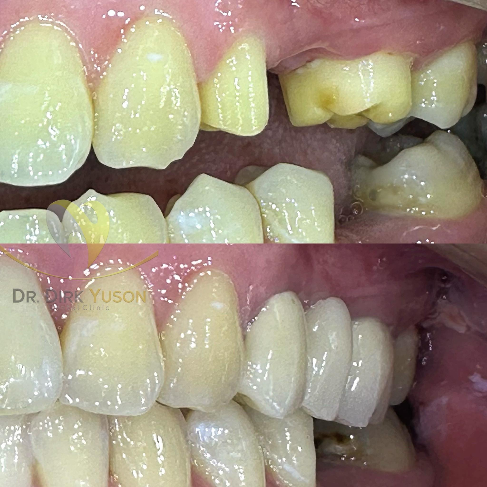 Transform Your Smile with... - Dr. Dirk Yuson Dental Clinic | Facebook