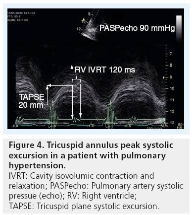 الدكتور - 💪 Right Ventricle Deserves Respect! When assessing RV ...
