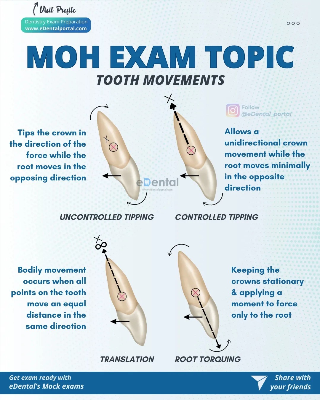 EDental - Did you know⁉️ There are different types of tooth movements ...