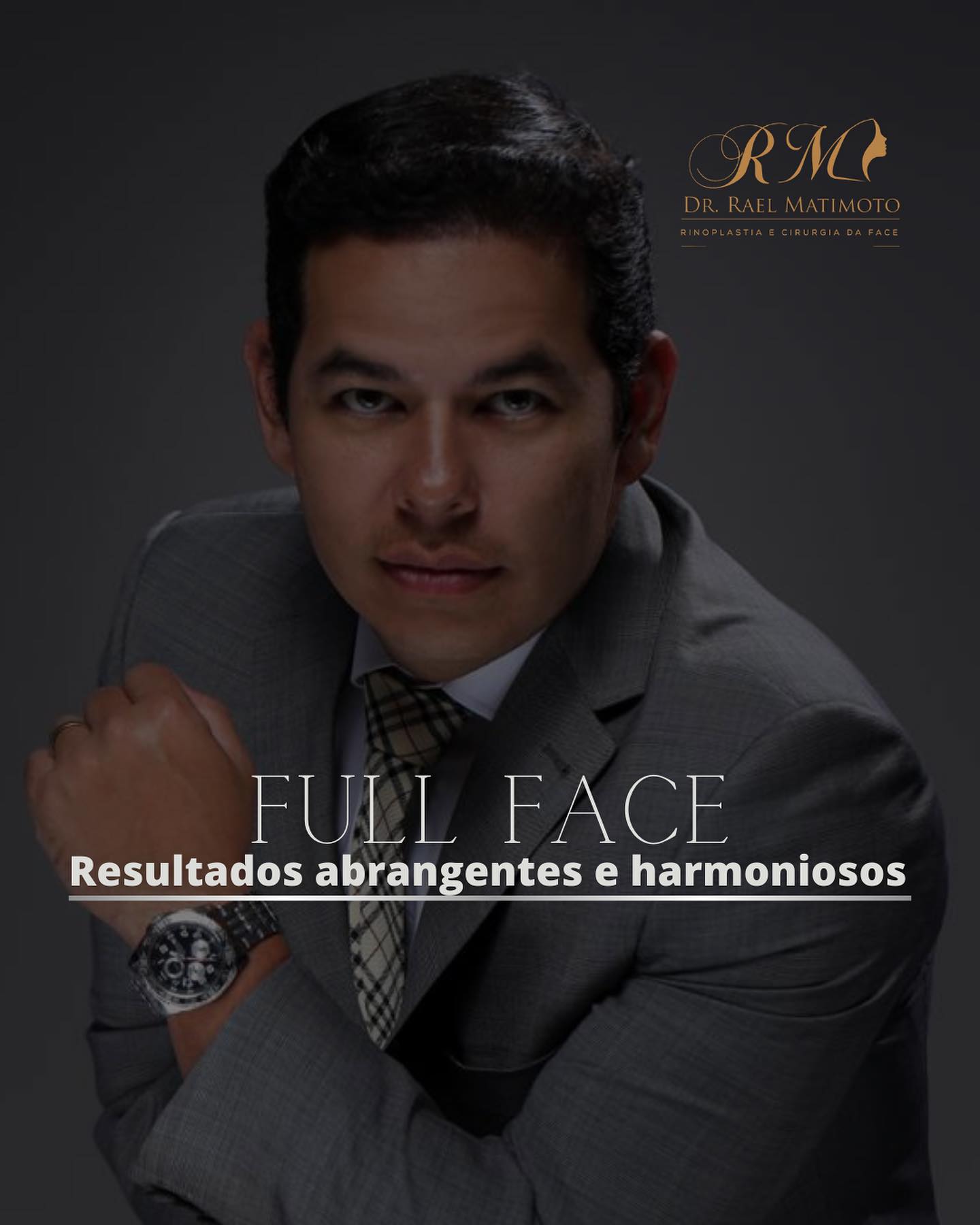 Full Face, é um tratamento... - Dr. Rael Lucas Matimoto | Facebook