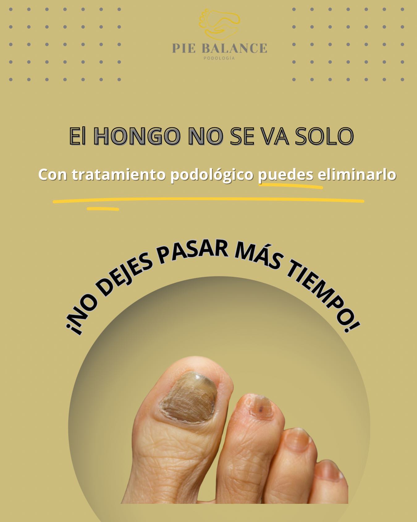 Pie - EL hongo en las uñas (onicomicosis) no desaparece solo; empeora ...