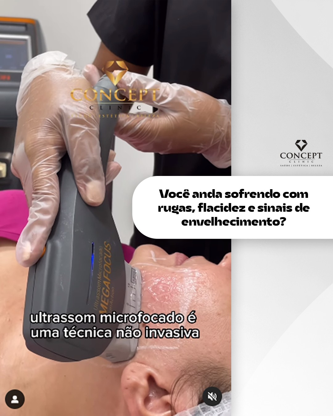 Concept Clinic - Flacidez facial incomoda muito e na busca por uma ...