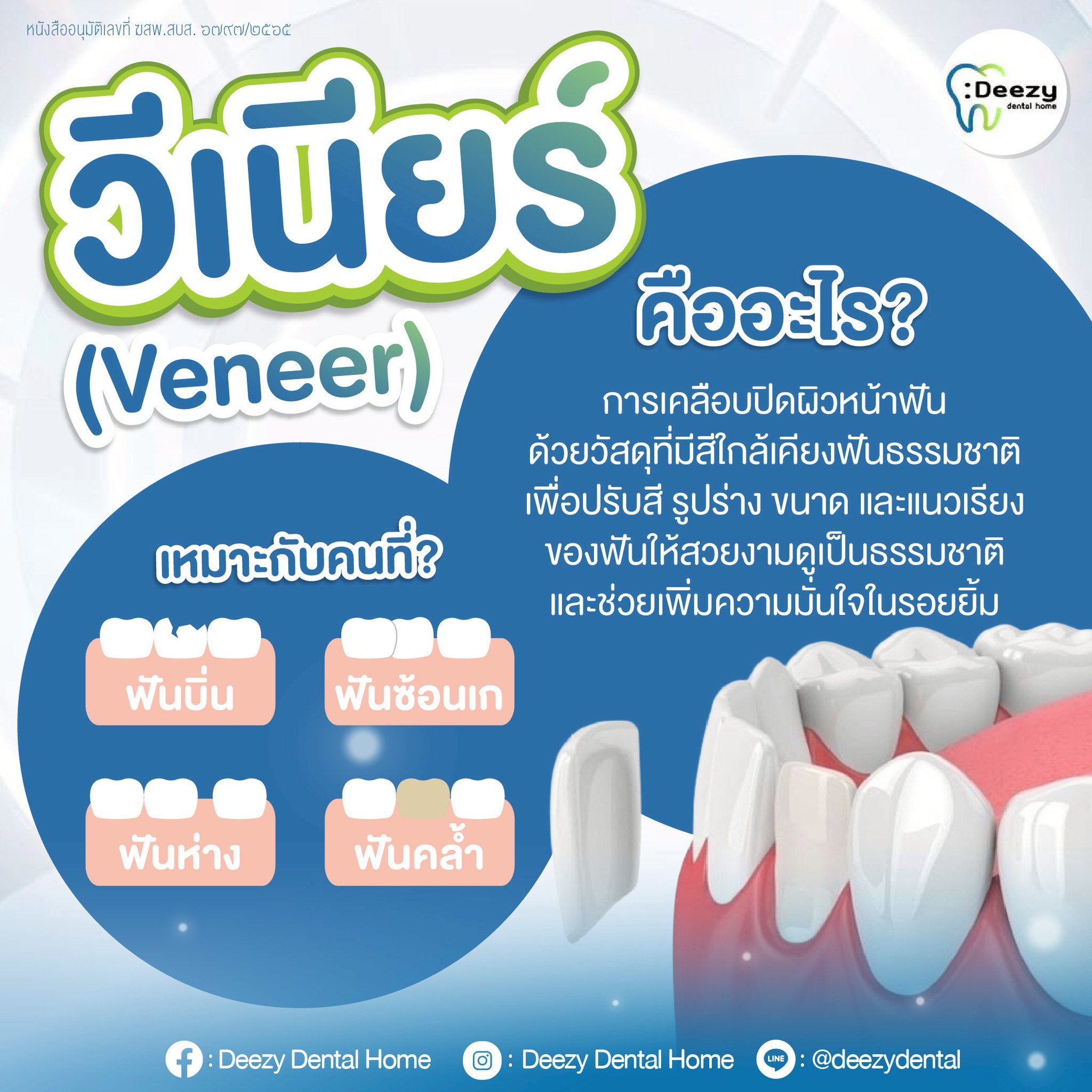 Deezy dental home คลีนิคทันตกรรม จัดฟันราคาถูก ฟอกสีฟันขาว วีเนีย ราก ...
