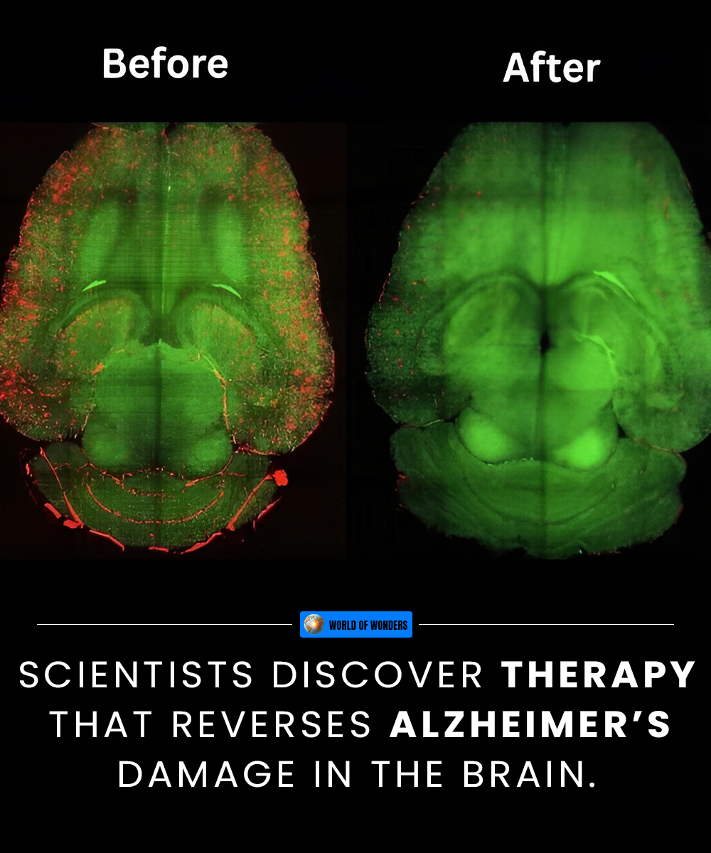 Amazing - Alzheimer’s Breakthrough: Memory Loss Reversed in Lab Tests ...