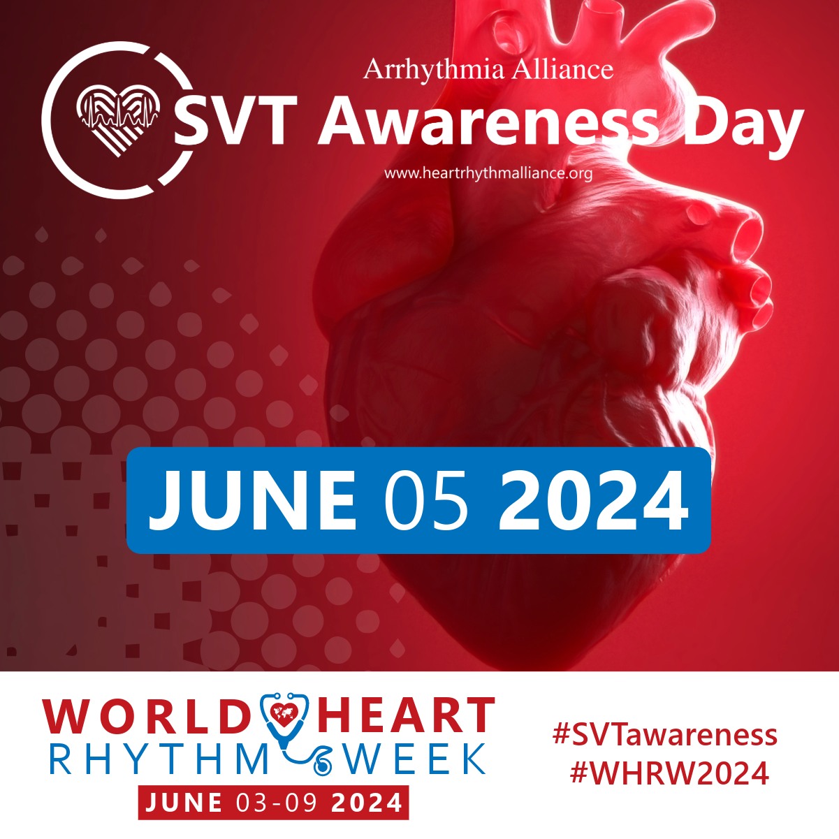 Preventive - June 4 is Supraventricular Tachycardia (SVT) Awareness Day ...