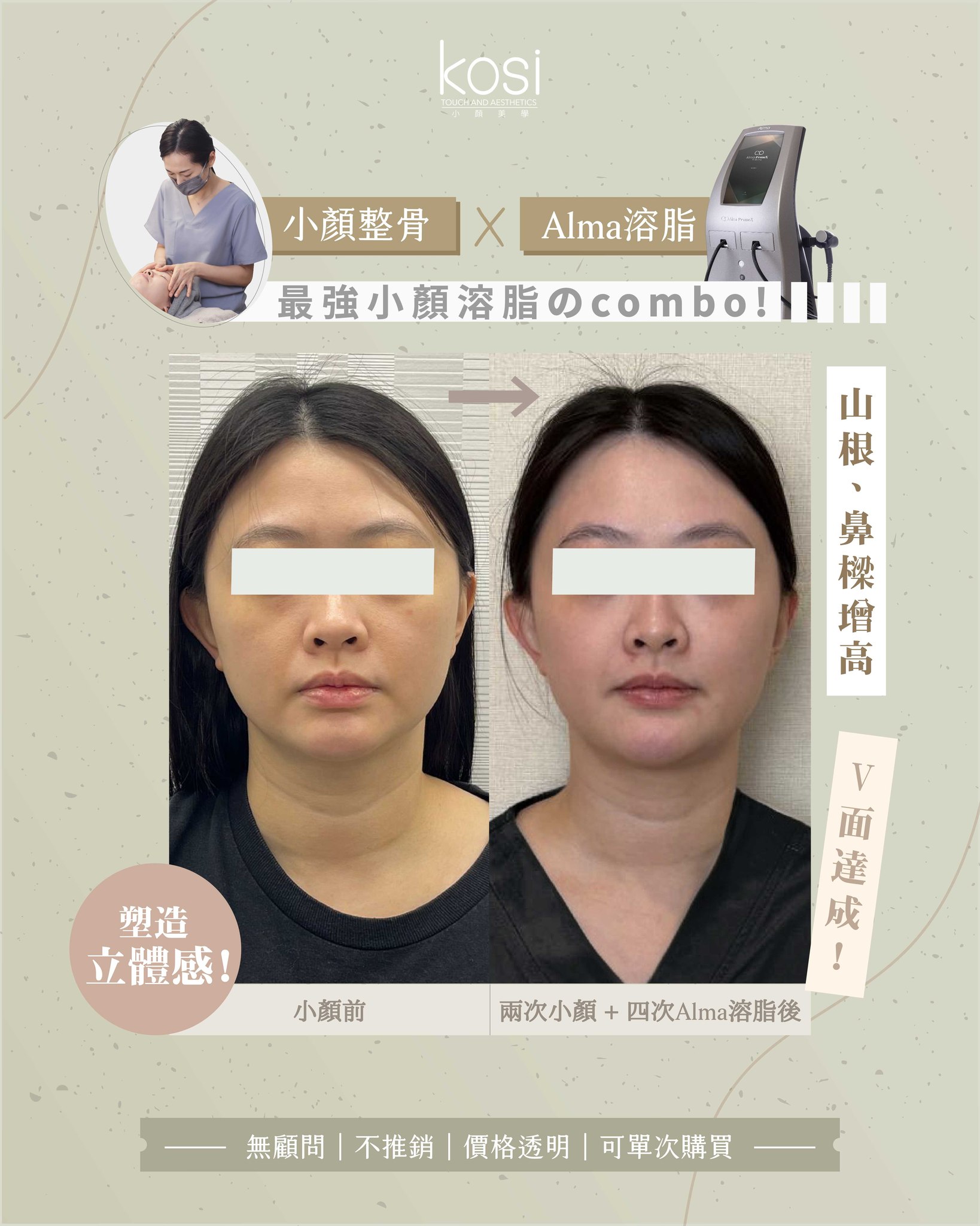 【真實小顏案例公開｜親眼見證改變💫】... - Kosi - Touch&Aesthetics | Facebook