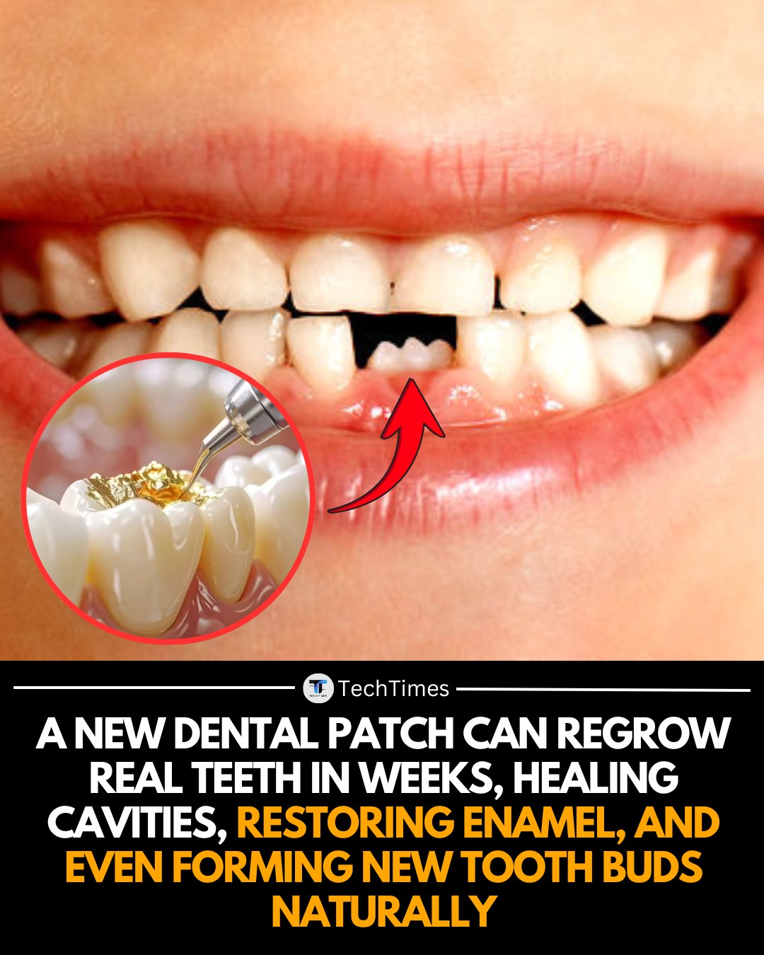 TechTimes - In a revolutionary breakthrough for dentistry, scientists ...