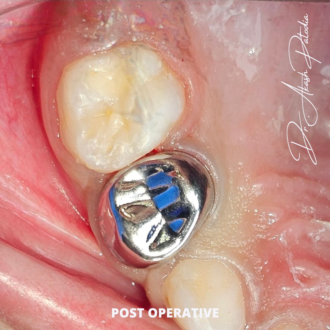 Nitrous Oxide Sedation Systems Smartsed Nitrous Oxide Oxygen