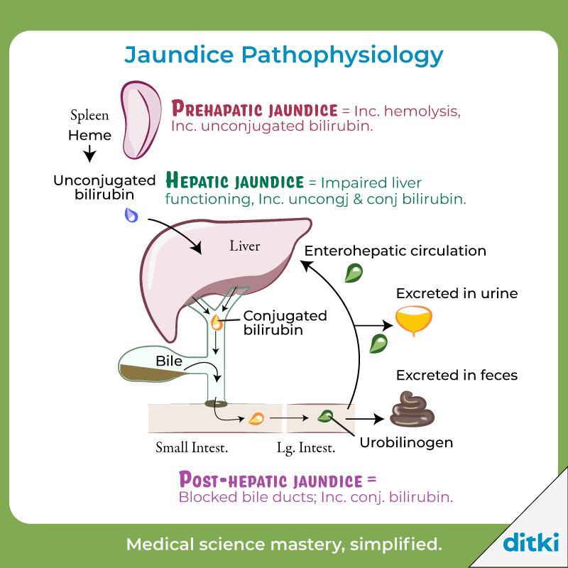 Ditki, - Learn more about Jaundice with our stepwise, instructional ...