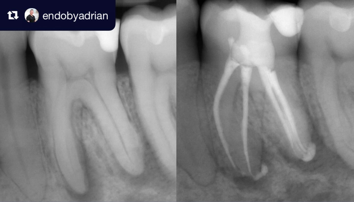 Marlborough - Specialist Endodontic referrals ...
