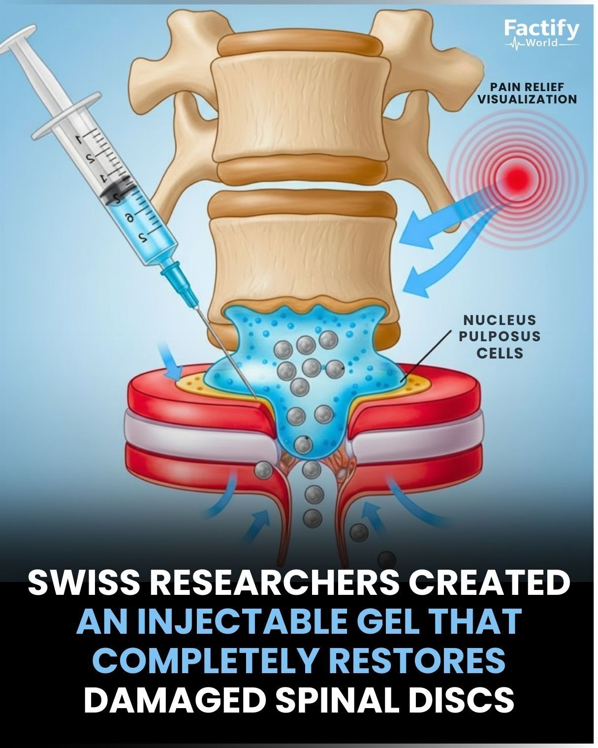 Factify - An innovative injectable gel developed in Switzerland shows ...