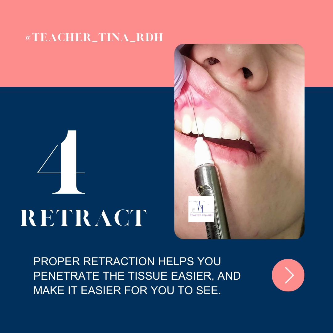 The ASA injection is perfect to numb... - Teacher Tina RDH