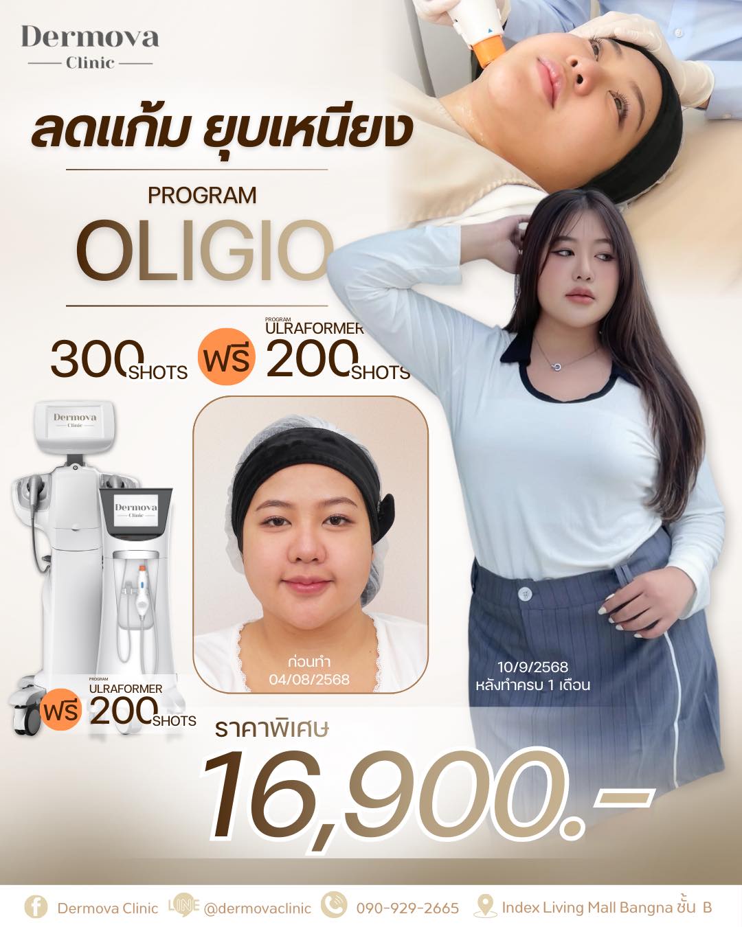 Dermova - น้อมรำลึกในพระมหากรุณาธิคุณของ สมเด็จพระนางเจ้าสิริกิติ์ ...