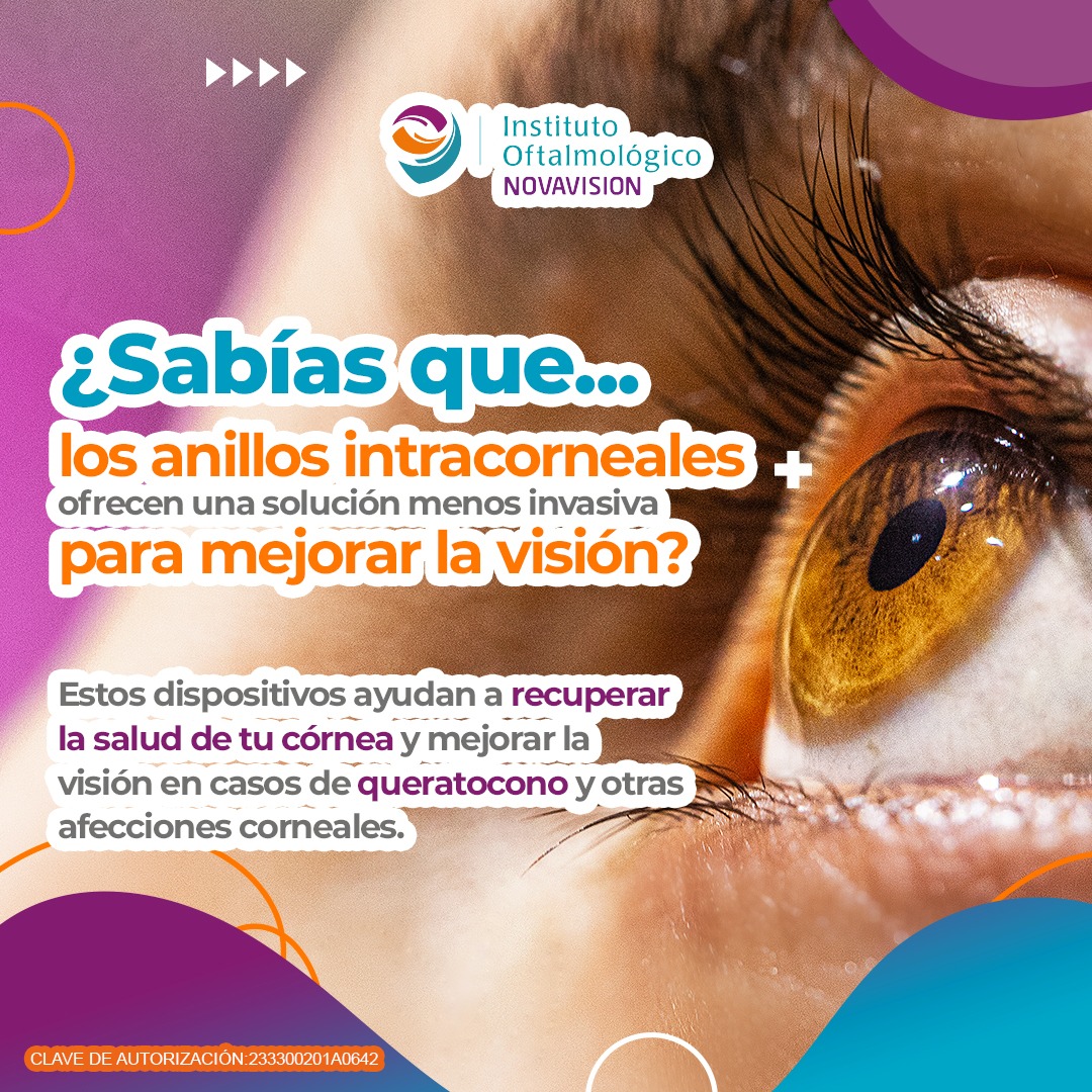 Instituto Oftalmologico Novavision | San Andrés Cholula