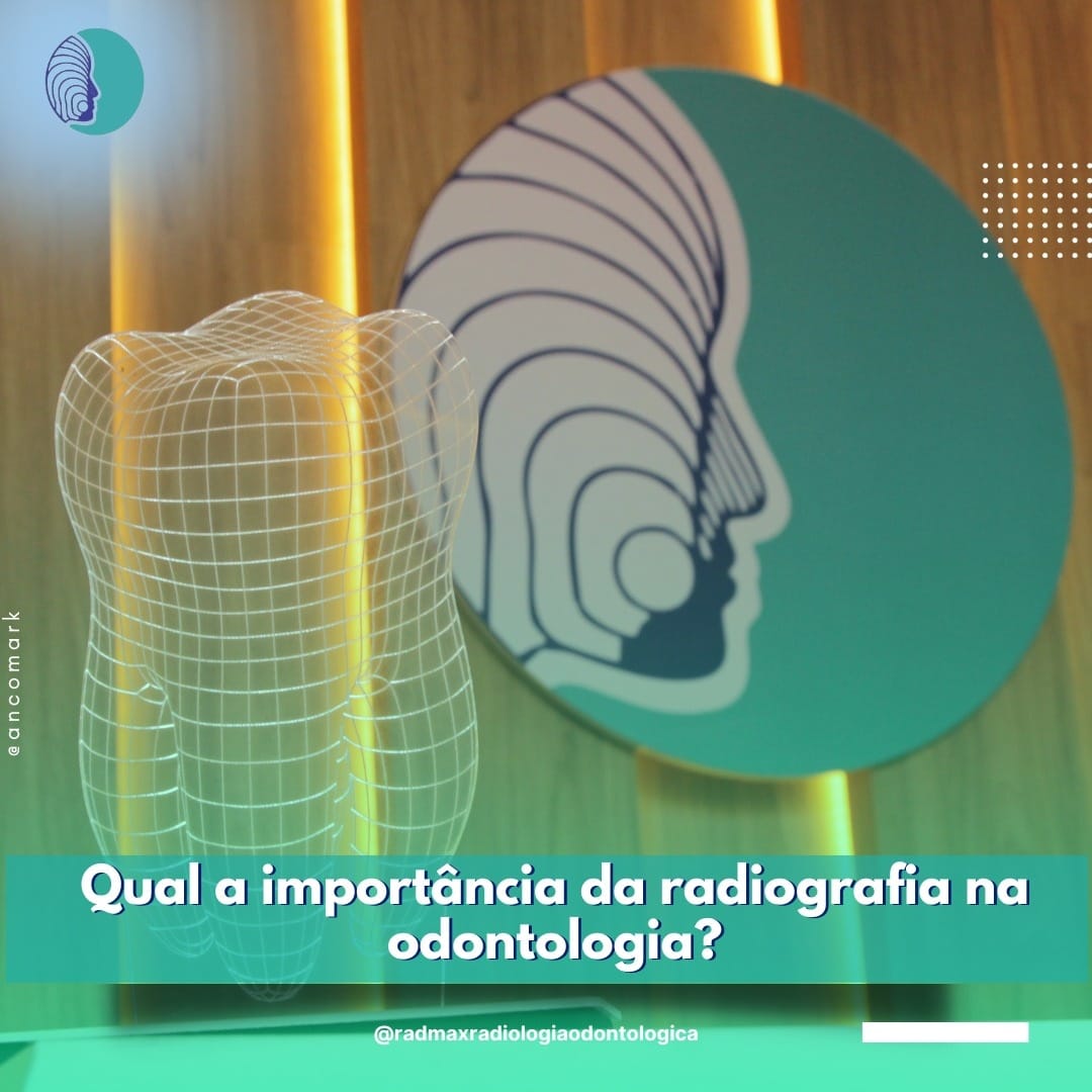 Os diferentes tipos de... - Radmax Radiologia Odontológica
