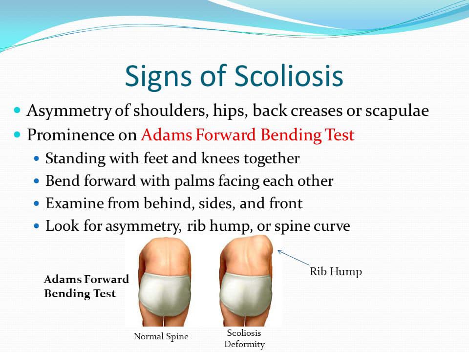 Today marks the end of Scoliosis... - Scoliosis_girl_96