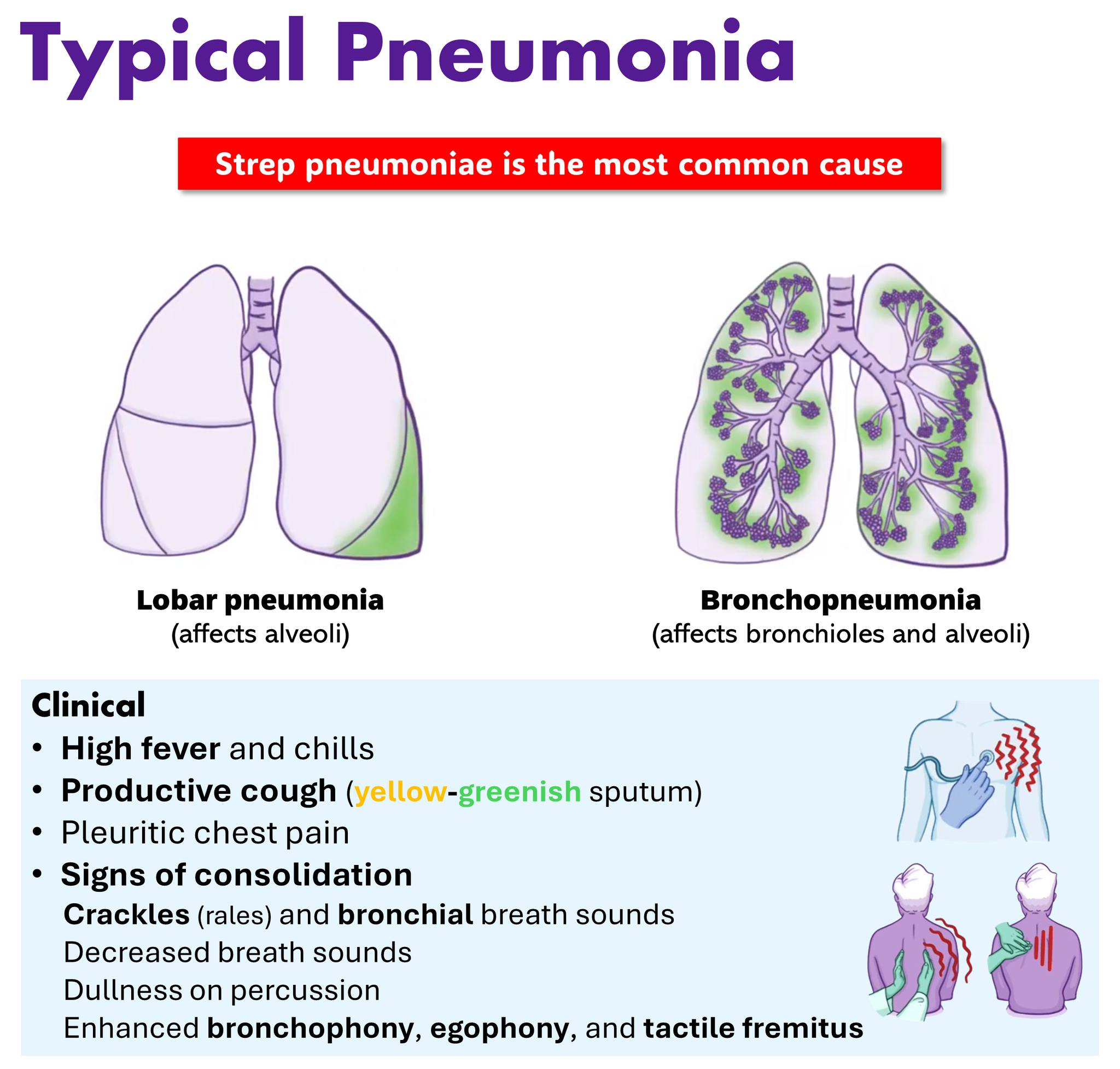 High yield notes... - Medicine Keys for Internal Medicine | Facebook