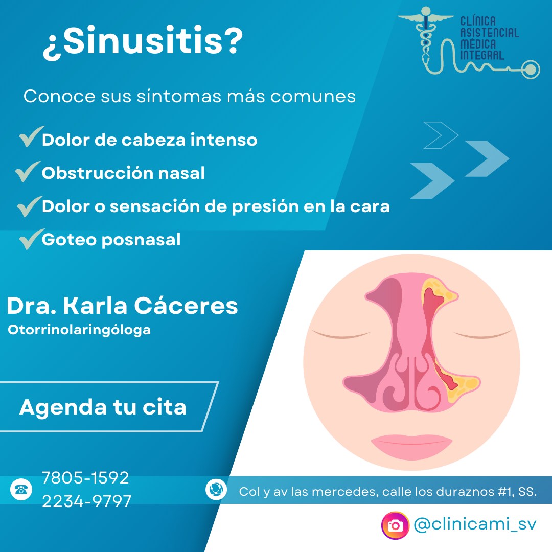 Clínica - ¡Hablemos de sinusitis! La sinusitis es la inflamación de uno ...