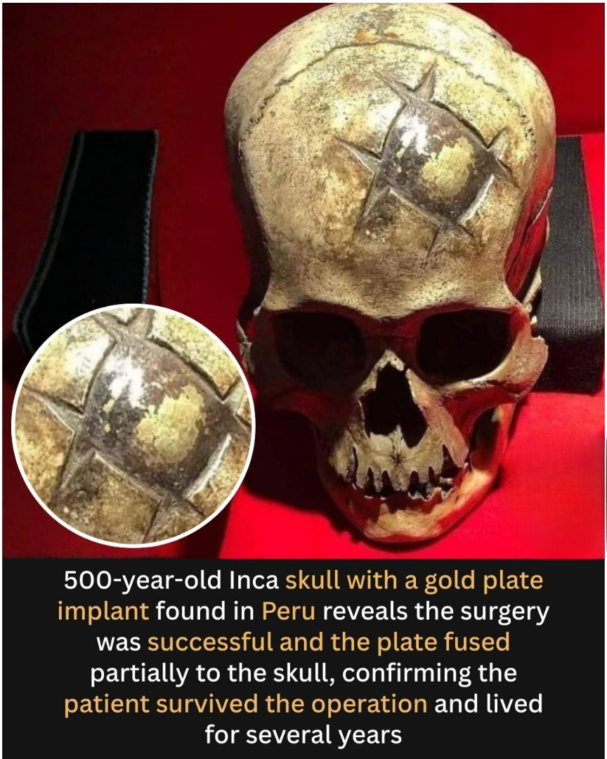 What if a skull from ancient Peru... - Ancient Discoveries | Facebook