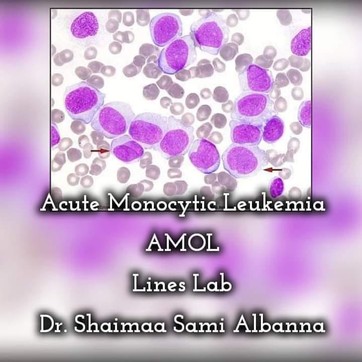 What is acute... - Lines Lab 