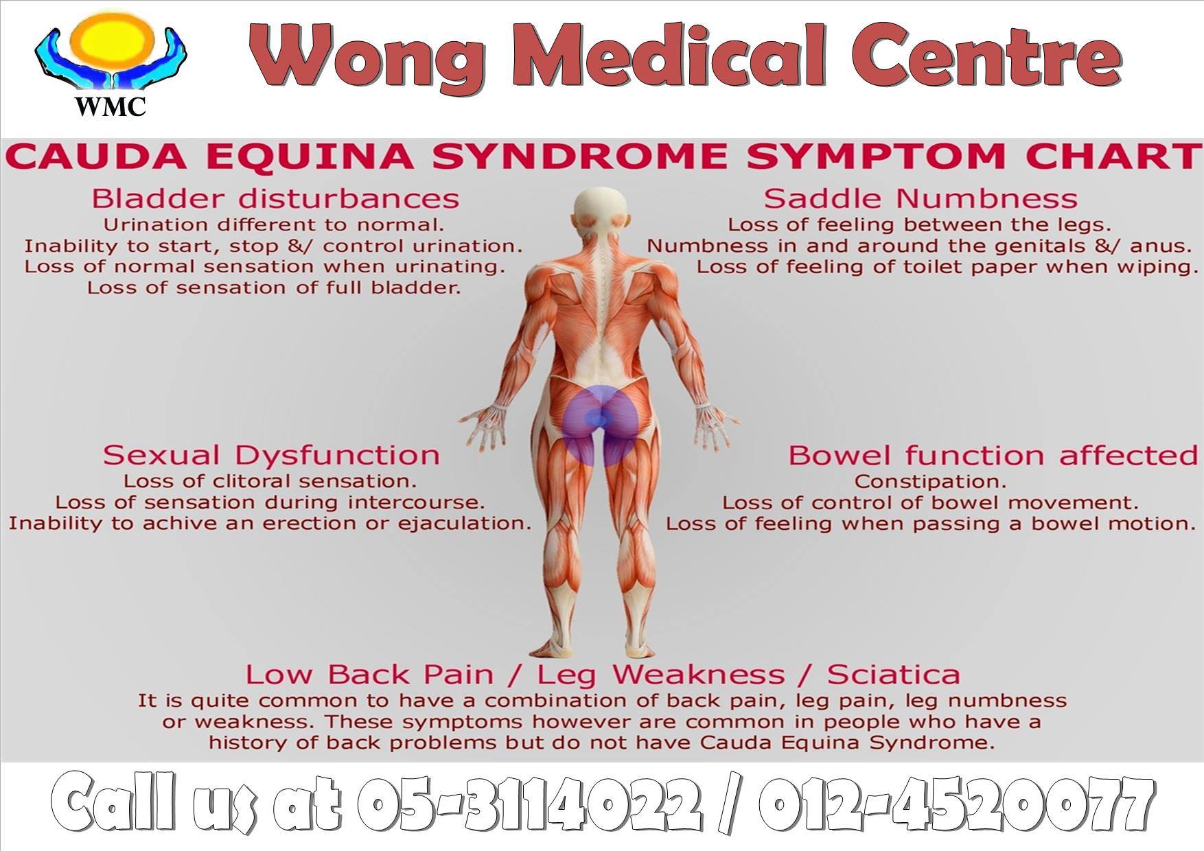 Spinal - Cauda equina syndrome is a rare and severe type of spinal ...