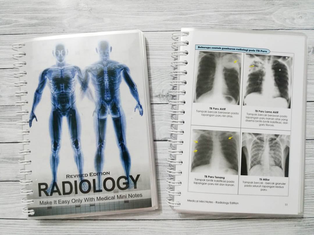 MMN Radiologi berisi petunjuk2... - Medical Mini Notes