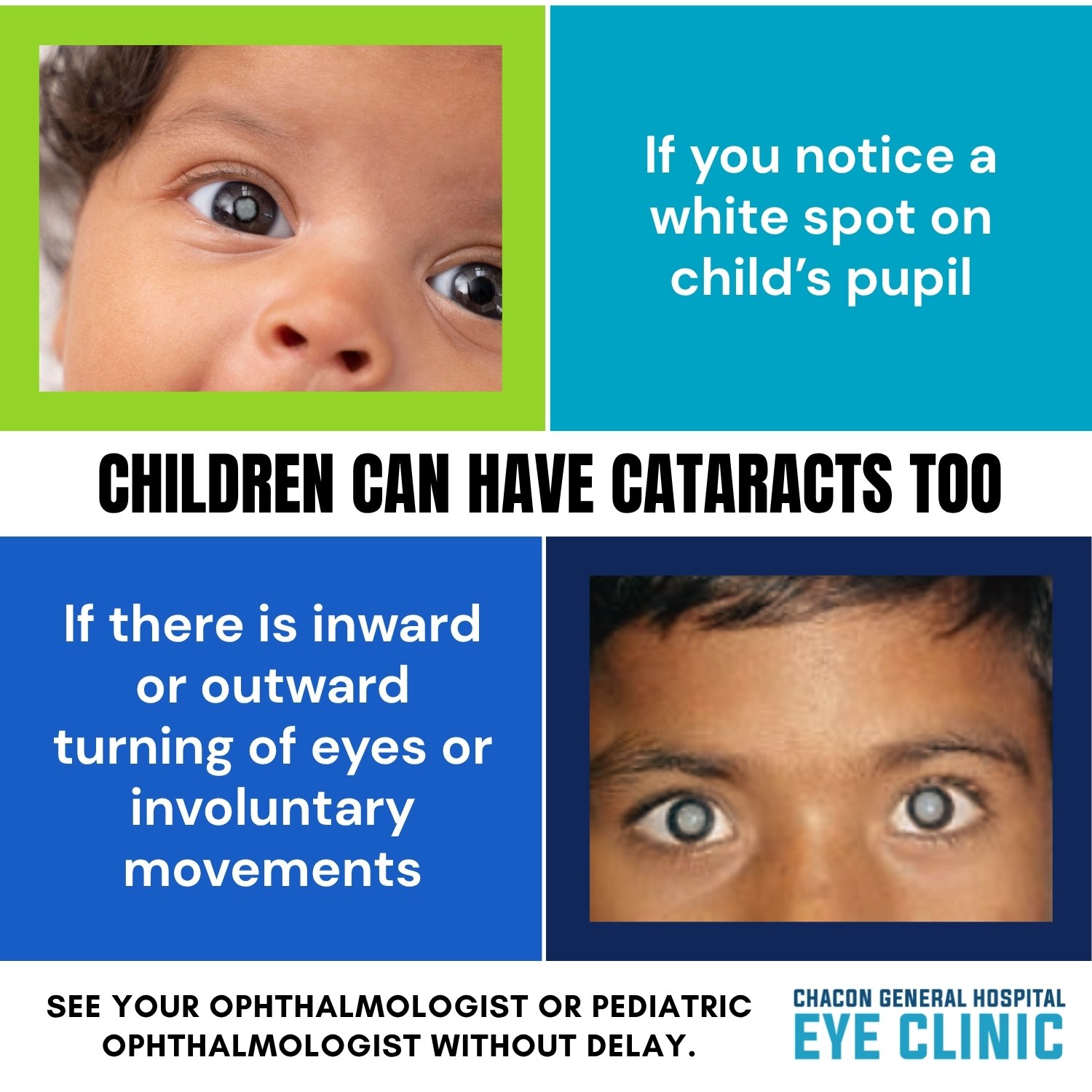 Chacon - Children can have cataracts too. If you notice: - WHITE SPOT ...