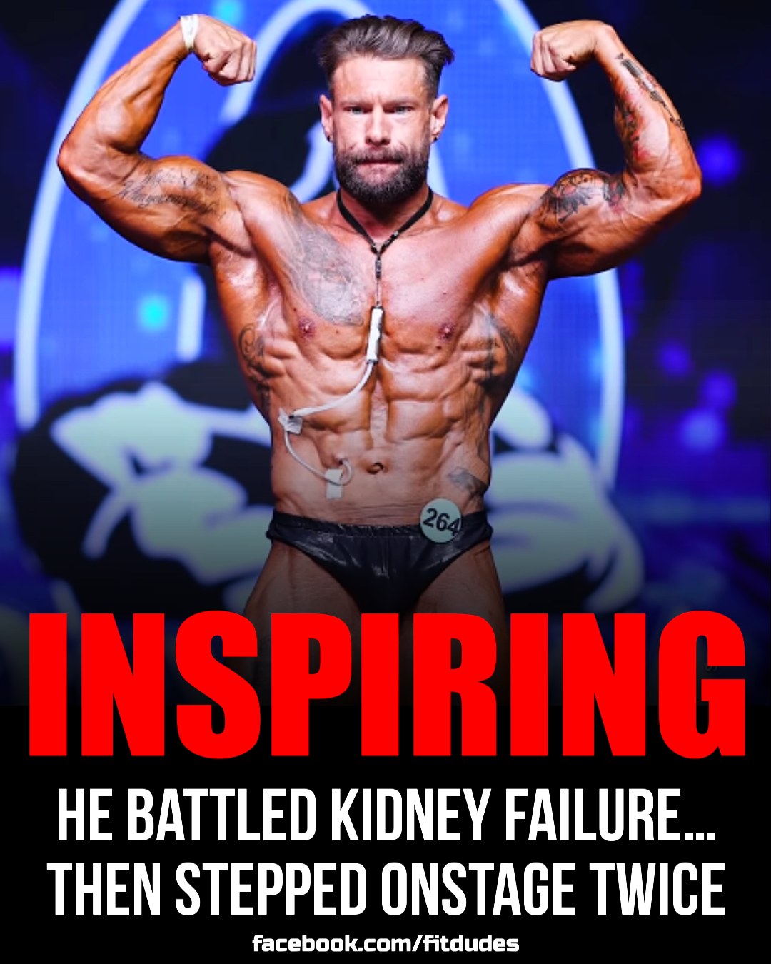 Fit Dudes - 🔥 “For a guy in kidney failure… I think that’s... | Facebook