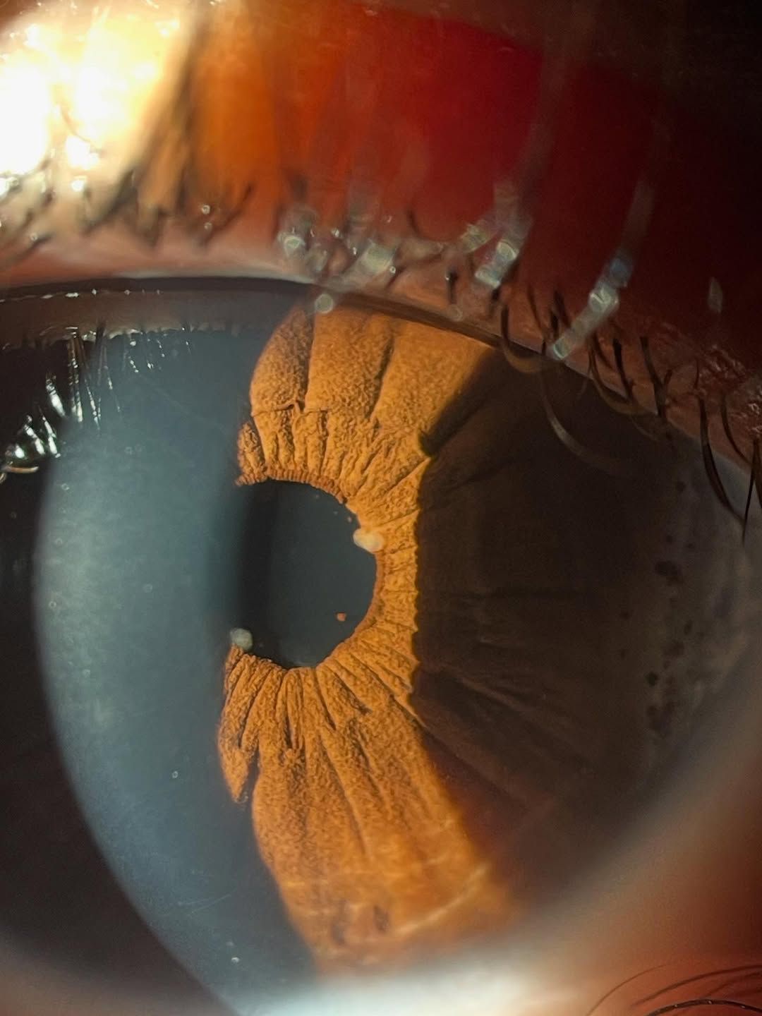 Eyeball world - What two signs are you spotting from this... | Facebook