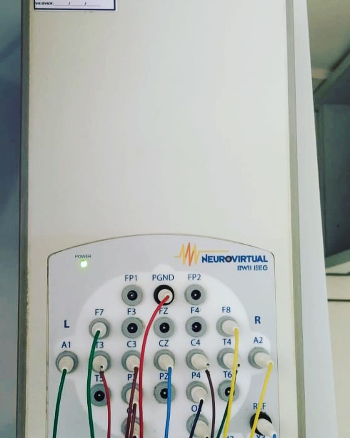 Precision - Eeg 🤑 #eeg #eletroencefalograma #neurovirtual #eletro # ...
