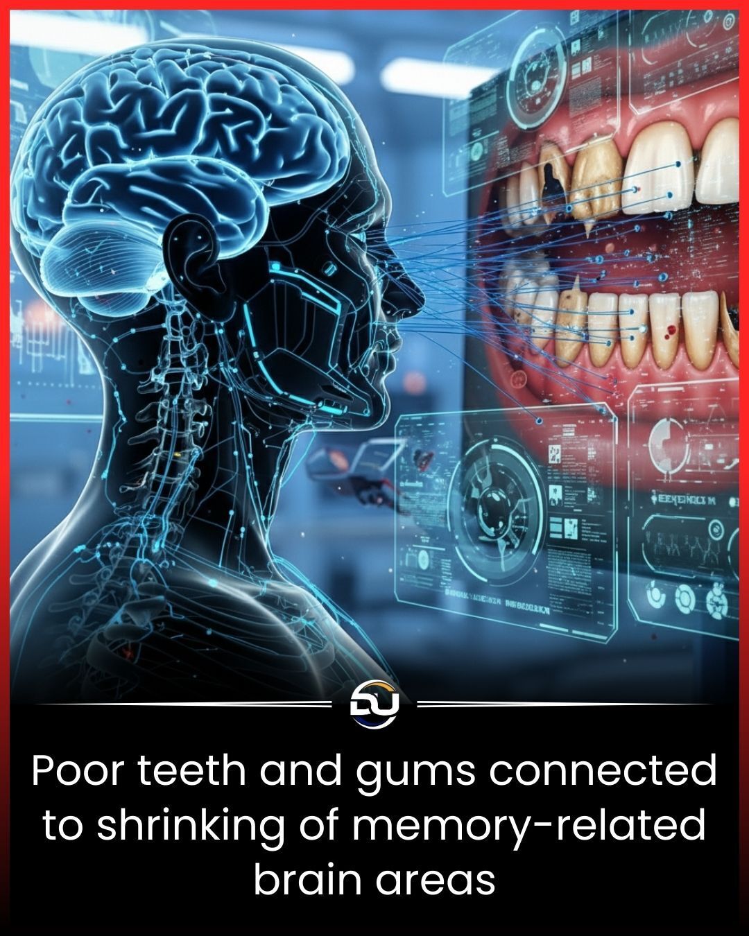 Discover - Neglected teeth may shrink the very part of your brain ...
