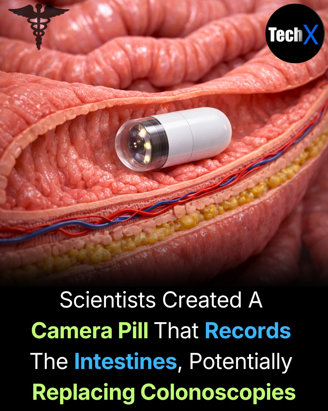 Tech - Scientists can now diagnose digestive problems using a single ...