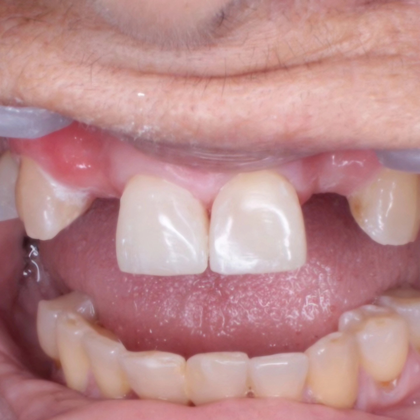 Tree Dent Consultorio Dental | Tuxtla Gutiérrez