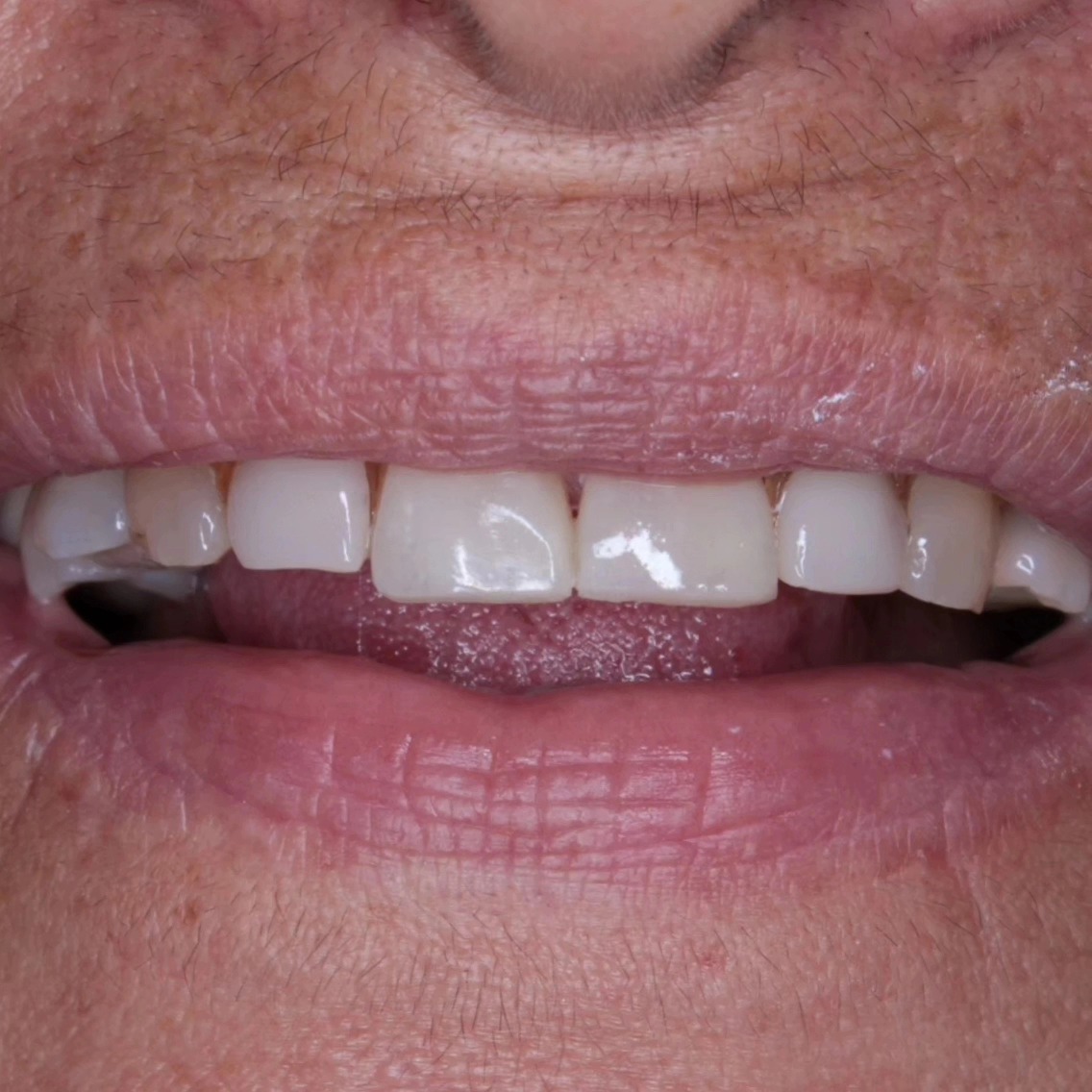 Tree Dent Consultorio Dental | Tuxtla Gutiérrez