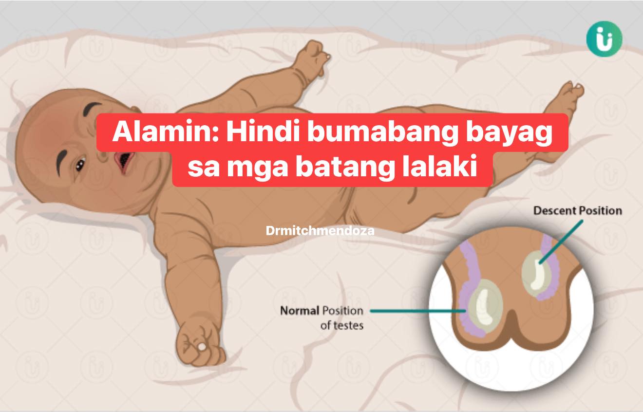 ‼️Parenting Guide: AMOEBIASIS-... - Dr.Mitch V. Mendoza | Facebook