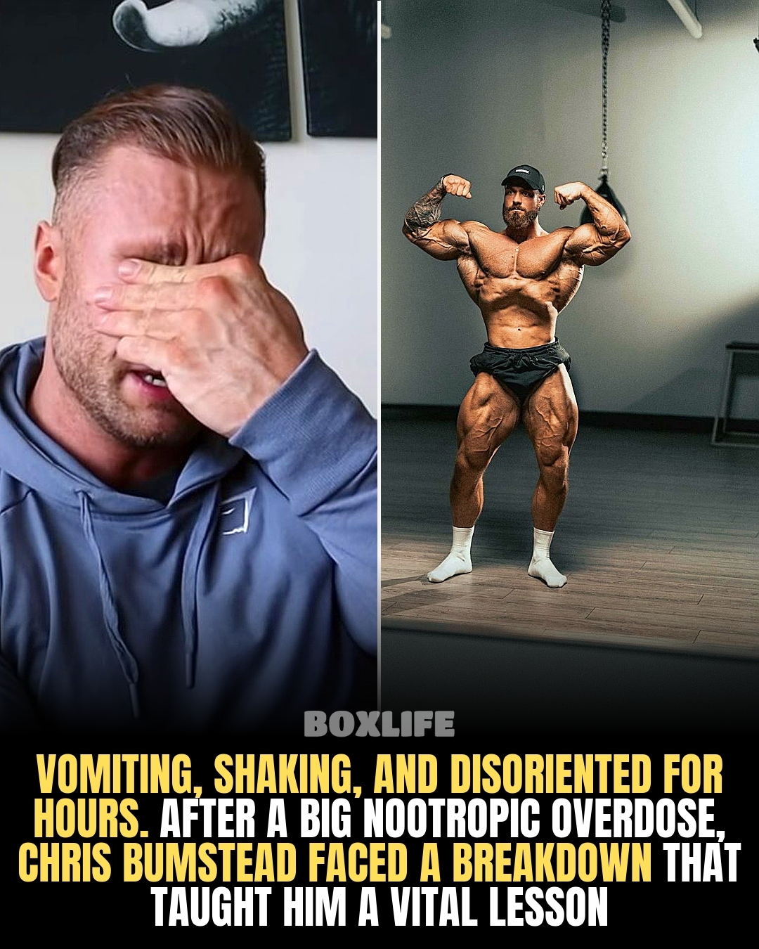 Chris Bumstead experienced severe vomiting, tremors, and hours of disorientation after pushing a nootropic overdose. This breakdown forced the athlete to re-examine his approach to performance enhancement and mental optimization. He discovered