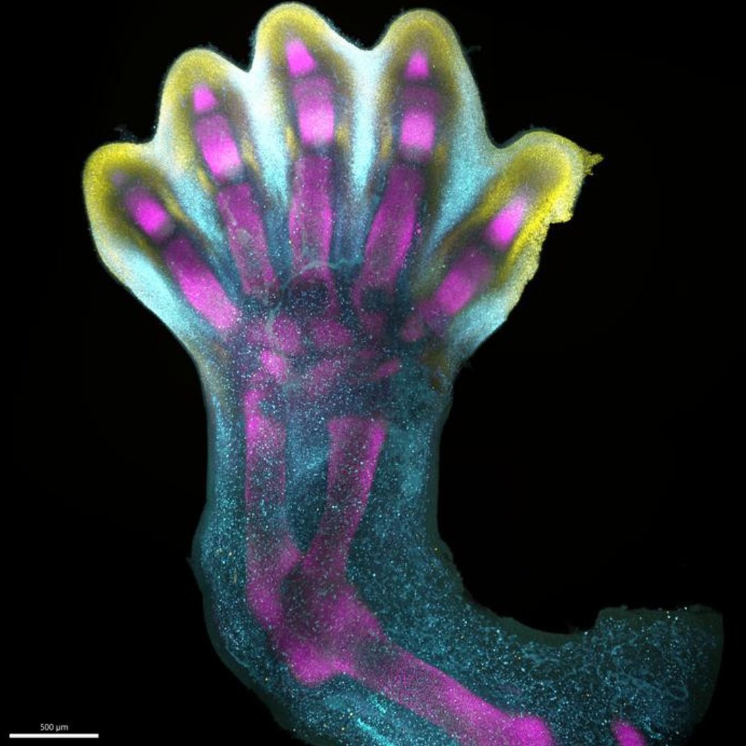 How do fingers and toes grow?... - BBC Science Focus Magazine | Facebook