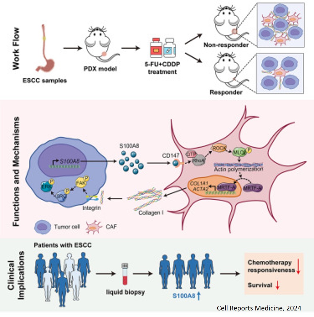 Science - Mechanism of chemoresistance in esophageal cancer The ...