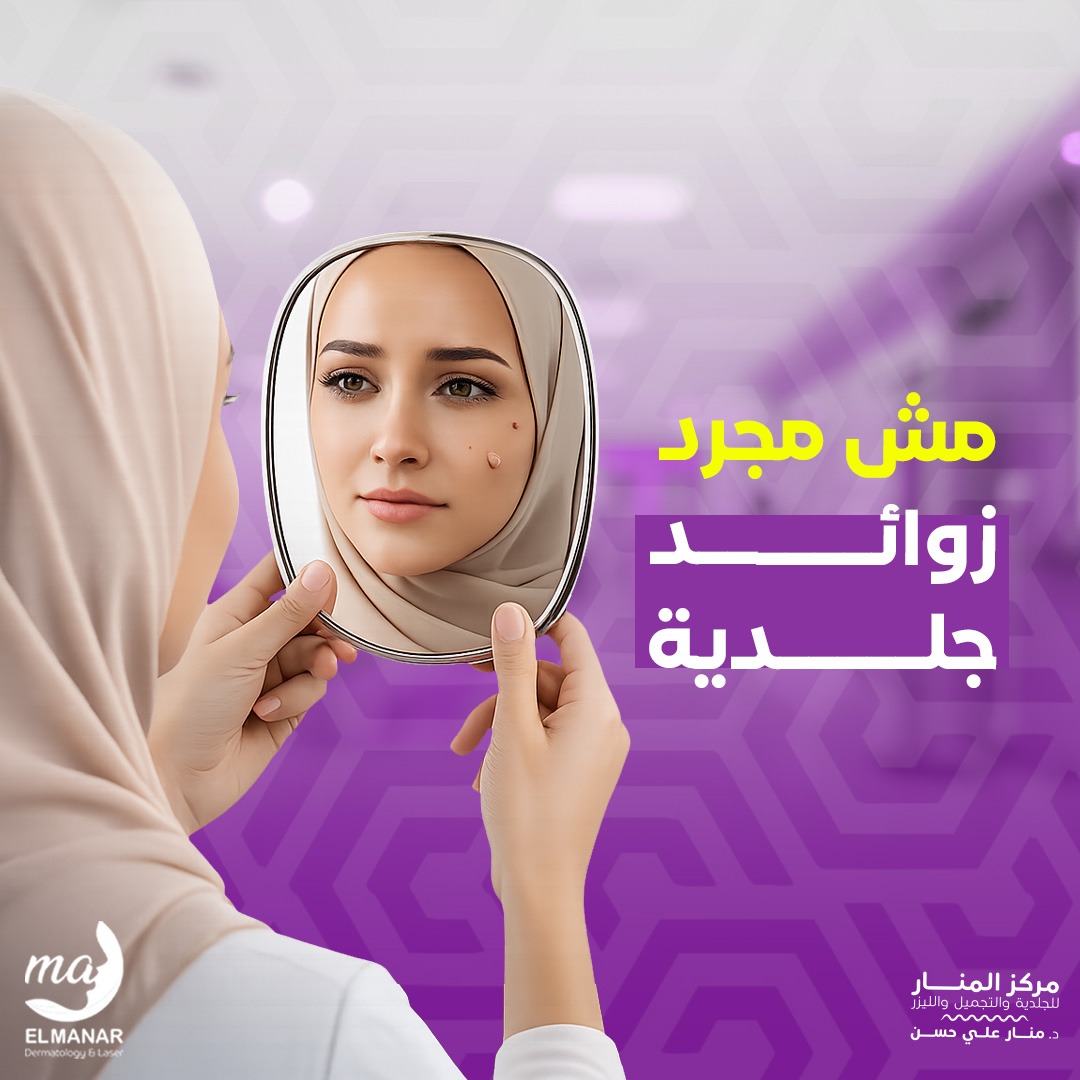 مش... - مركز المنار للجلدية والتجميل والليزر - د. منار علي حسن | Facebook