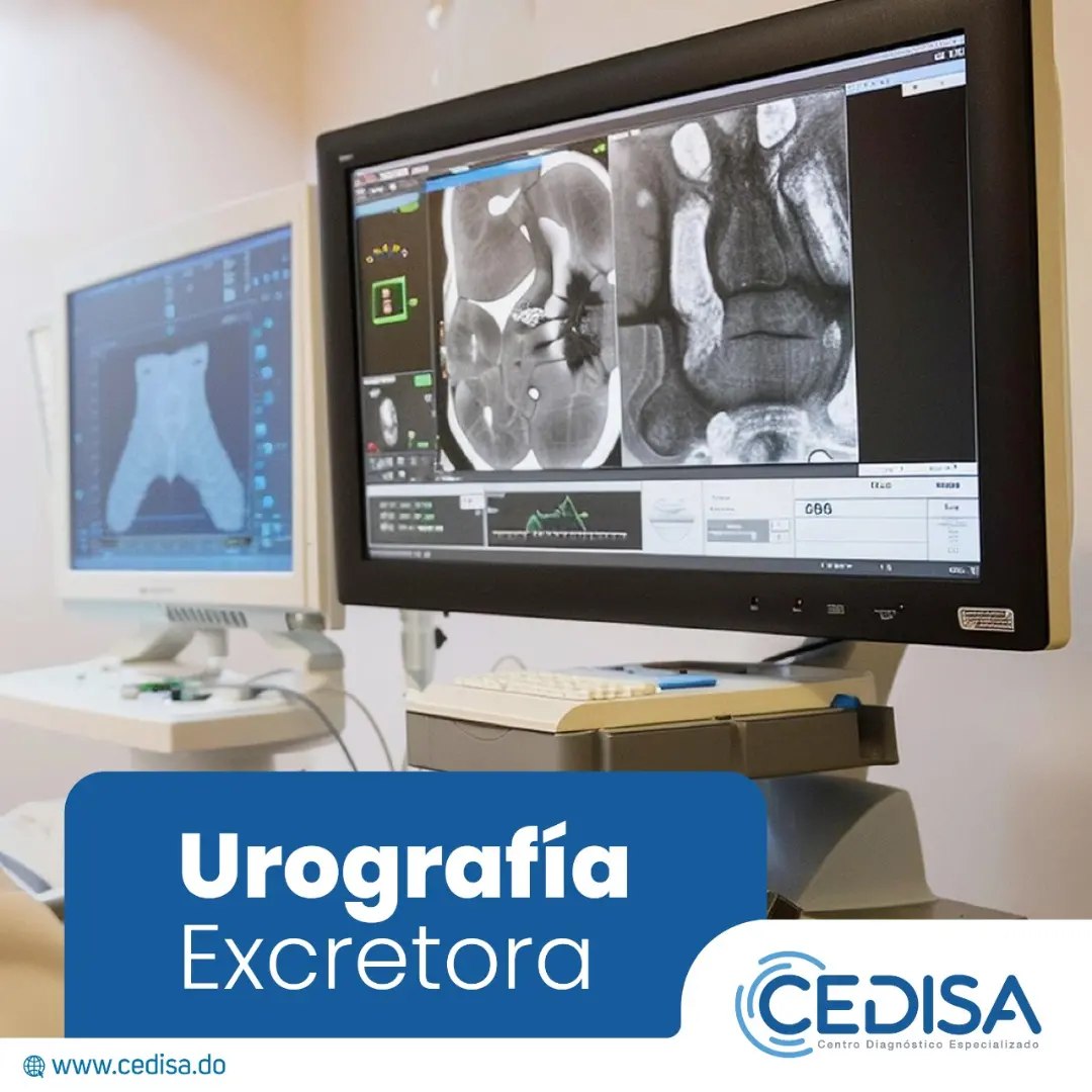 Cedisa - La urografía es un tipo de examen que se usa para evaluar los ...