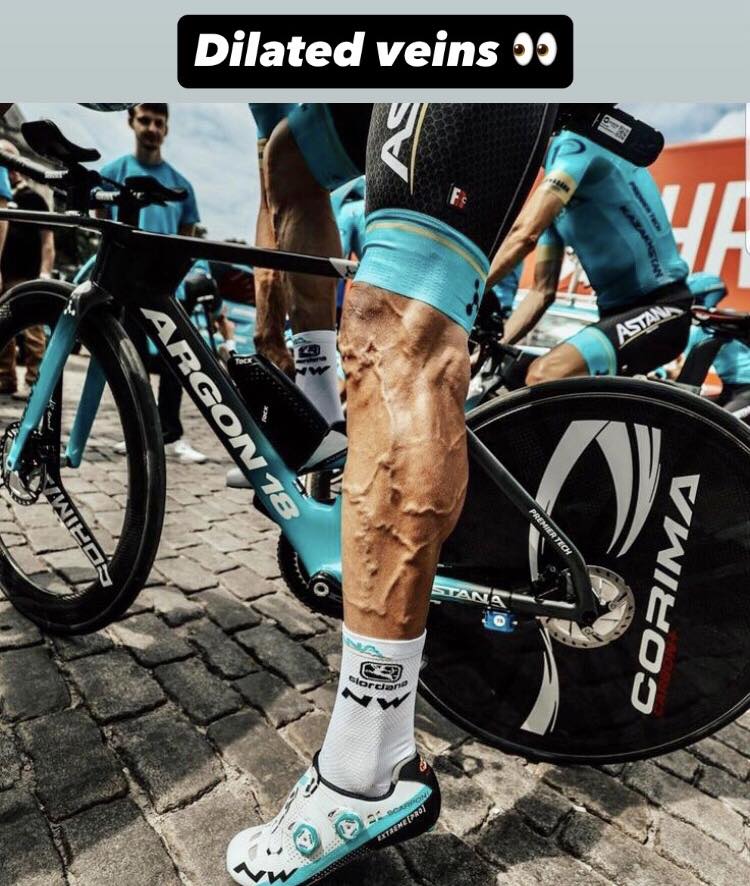 Vintage - The legs of Luis León Sánchez Team: Astana Tour de France ...