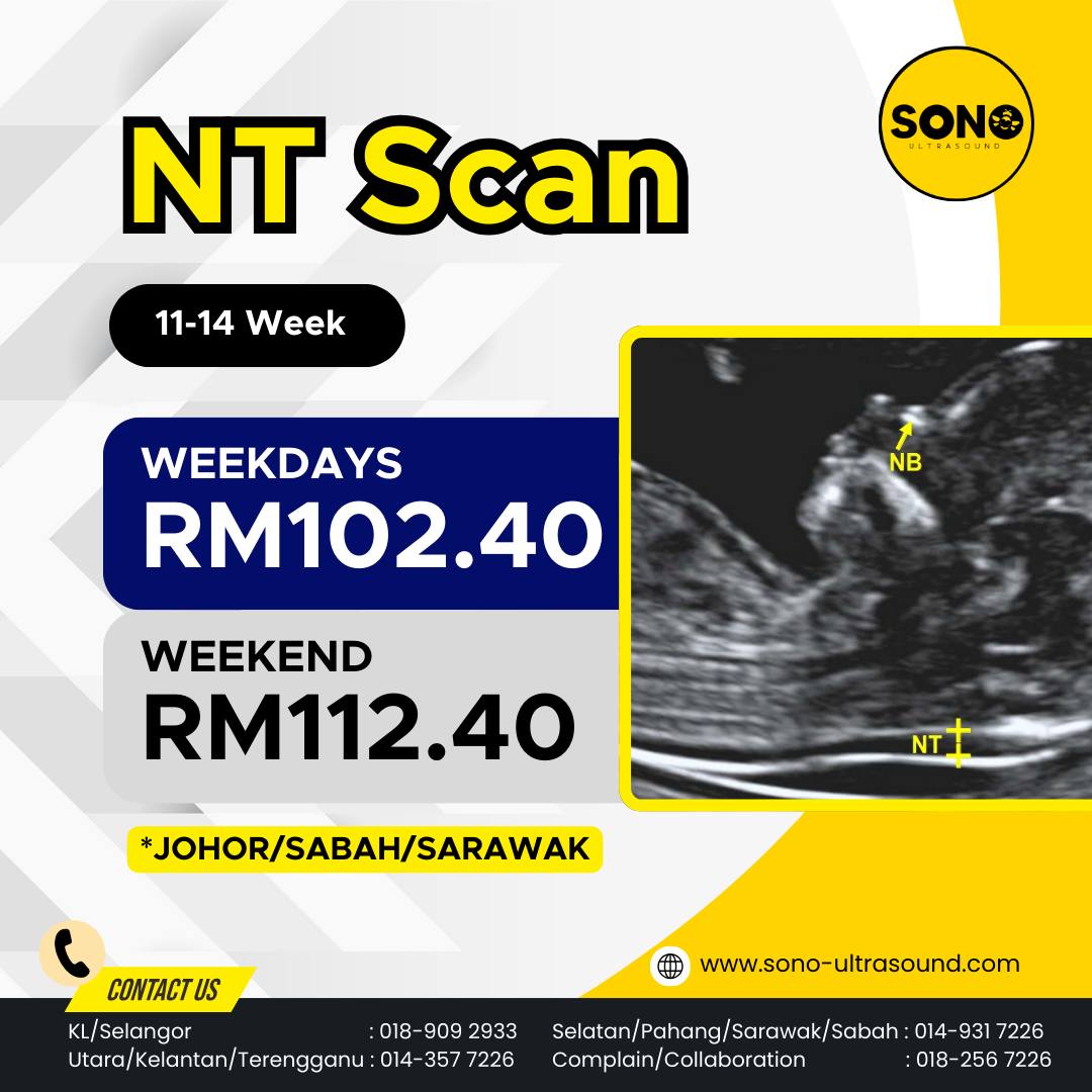 Sonobee - What is NT Scan? A Nuchal Translucency (NT) scan is a first ...