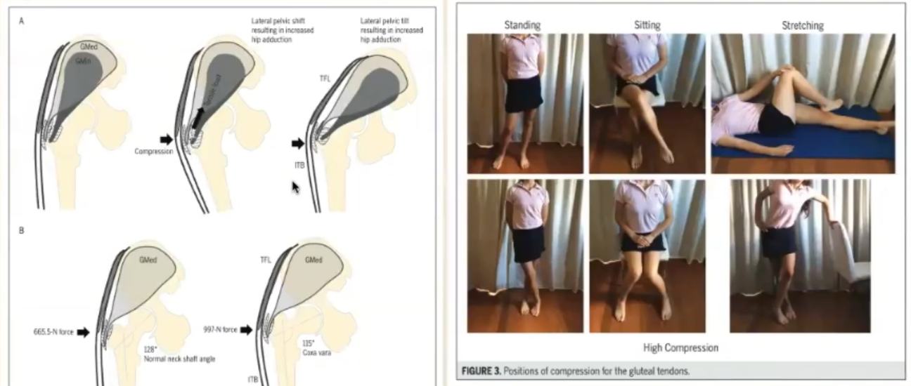 黃鈺翔中醫師。診間密藏精緻醫療的紀錄本 - What's Up Anatomy 什麼什麼解剖課 Day 14 站姿不佳(三七步、交叉步、斜倚站 ...