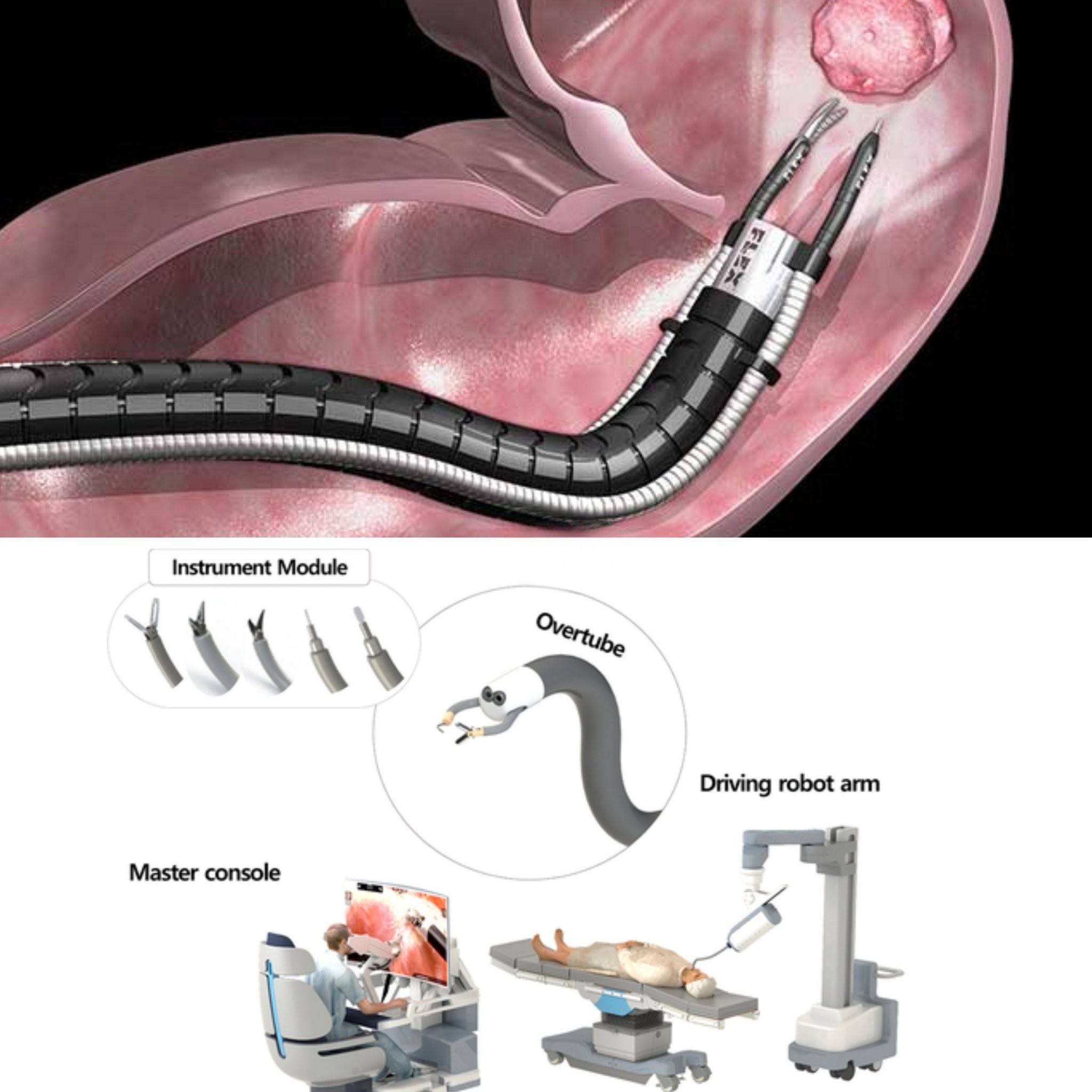 Unique - 🫀🔪🤖👨🏻‍🔬😳 A robot thinner than a pen is already performing ...