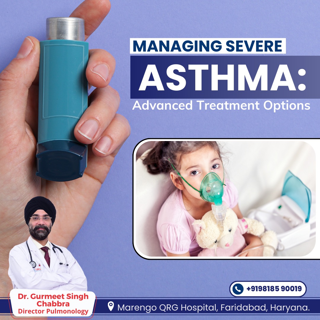 Switching biologics in severe asthma treatment