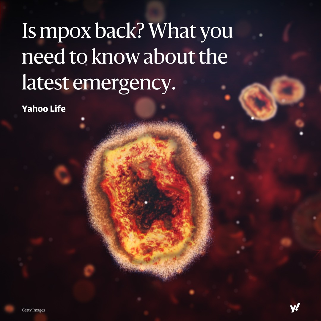 Yahoo News - The World Health Organization has declared...