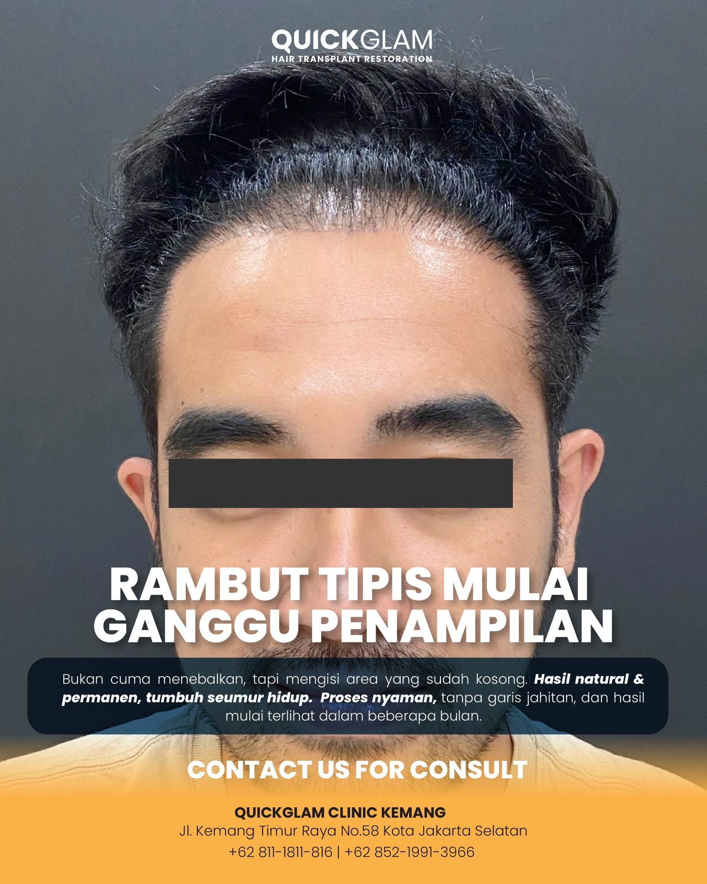 Quickglam Clinic | North Jakarta
