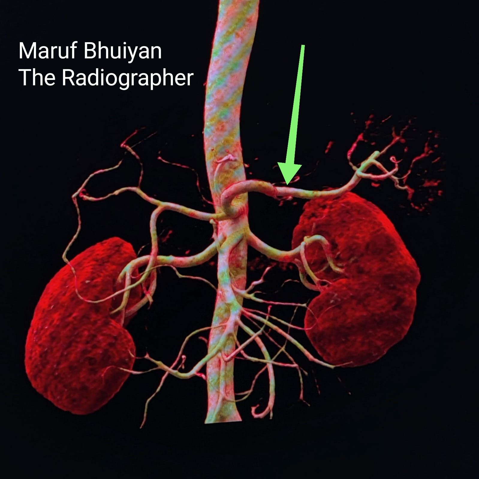 MR Defecogram Phases... - Maruf Bhuiyan The Radiographer | Facebook